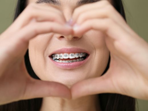 Hermosa mujer con aparatos dentales haciendo corazón con las manos sobre fondo de color